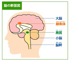 永六輔さんがなったパーキンソン病ってなに？